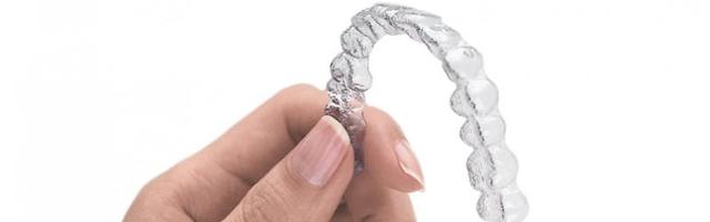 5 érdekes tény a láthatatlan fogszabályozásról