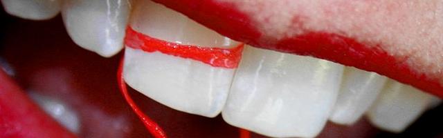 Kerüld el az ínygyulladást fogselyemmel!