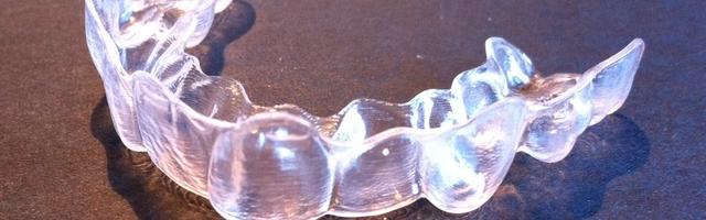 Fogszabályzó előtt, fogszabályzó után