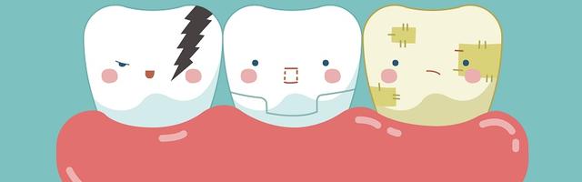 Milyen fogtömések léteznek?