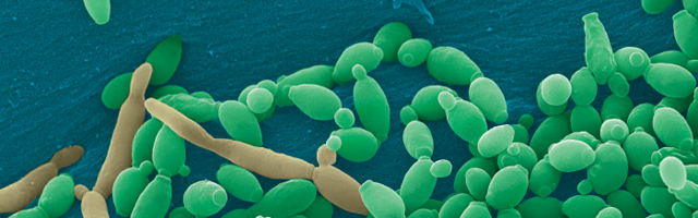 Candida a szájüregben? Mit tegyünk?