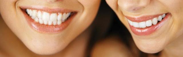 Fogfehérítés utáni teendők