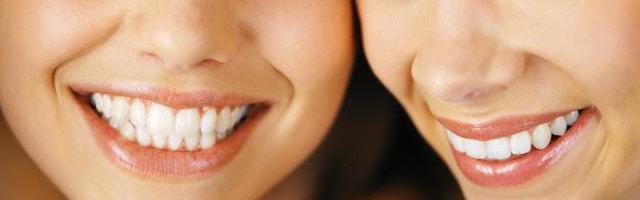 Hidrogén peroxid fogfehérítés otthon