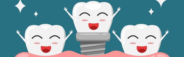 6 érv a fog implantátum mellett