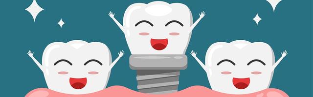 Fog implantátum – fájdalmas lenne?