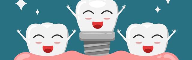 Milyen esetben ajánlott  fogimplantátum beültetése?