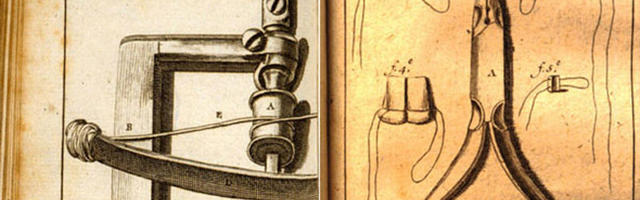 4 top sztori a fogszabályzás történetéből