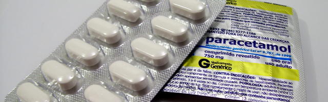 Anglia megszokhatatlan oldala