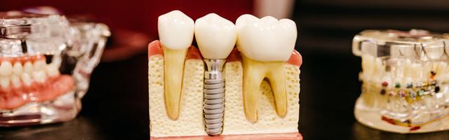 A fogtechnika jövője