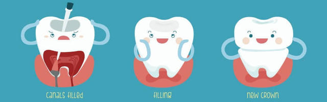 Mikor van szükség gyökérkezelésre?