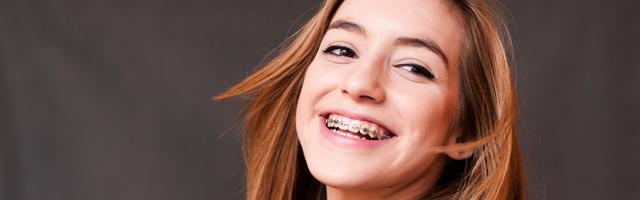 Tévhitek a fogszabályzóról