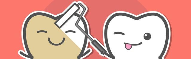 Fogfehérítés menete