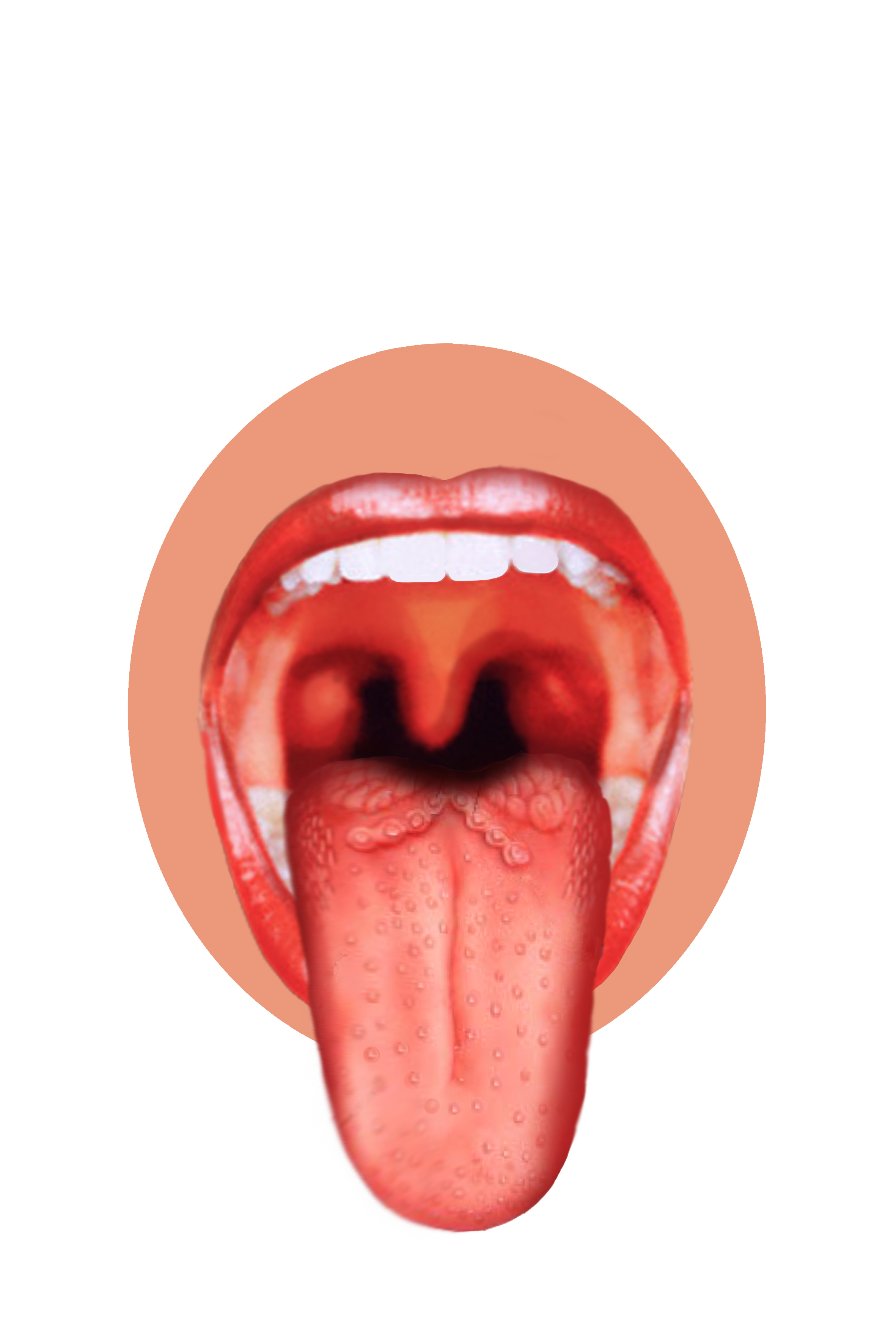 The Tongue Patch Diet | Hungarian Dentist in London